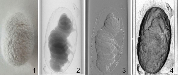 Phasenkontrastbildgebung Seidenraupe